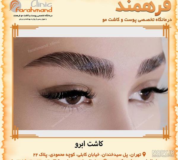 فیلم کاشت ابرو بدون جراحی فیلم کاشت ابرو بدون جراحی