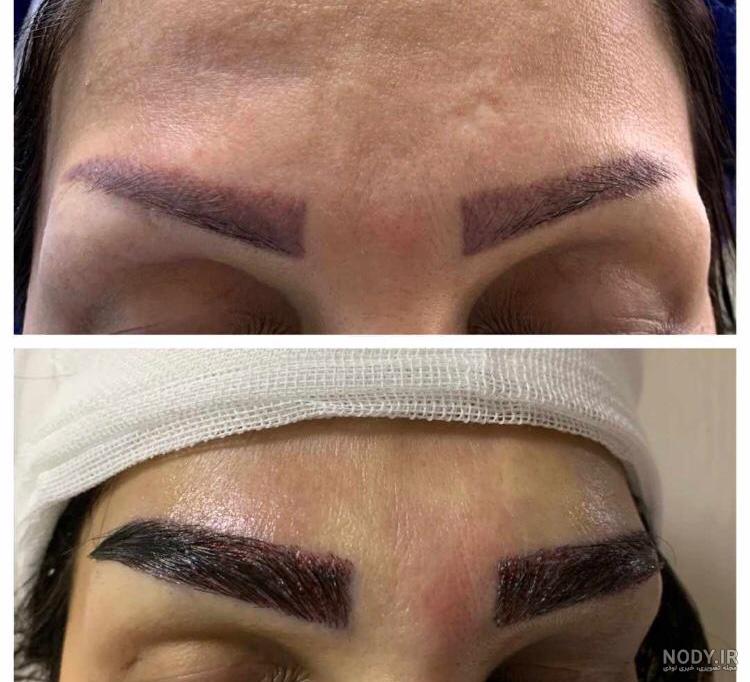 فیلم کاشت ابرو و مژه فیلم کاشت ابرو و مژه