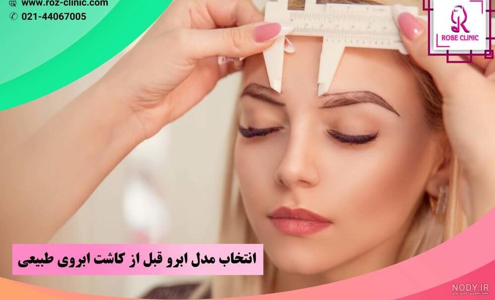 مزوتراپی ابرو بعد از کاشت مزوتراپی ابرو بعد از کاشت