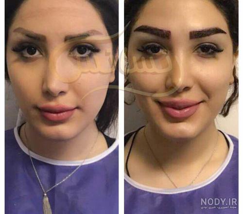 کاشت ابرو بعد از یکسال کاشت ابرو بعد از یکسال