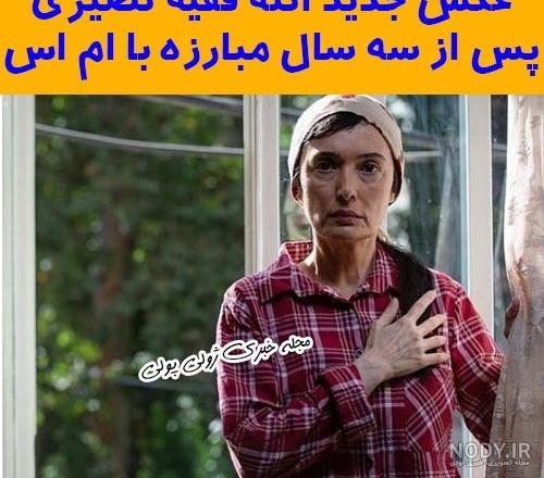 آتنه فقیه نصیری و ام اس