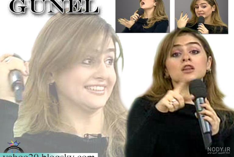 علت تغییر چهره گونل علت تغییر چهره گونل