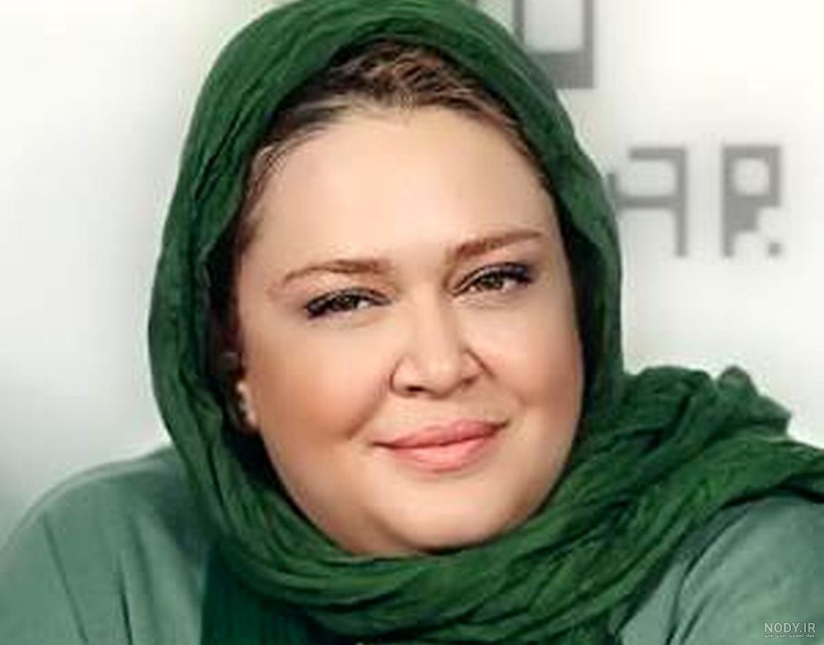 هزینه عمل اسلیو معده با بیمه تکمیلی