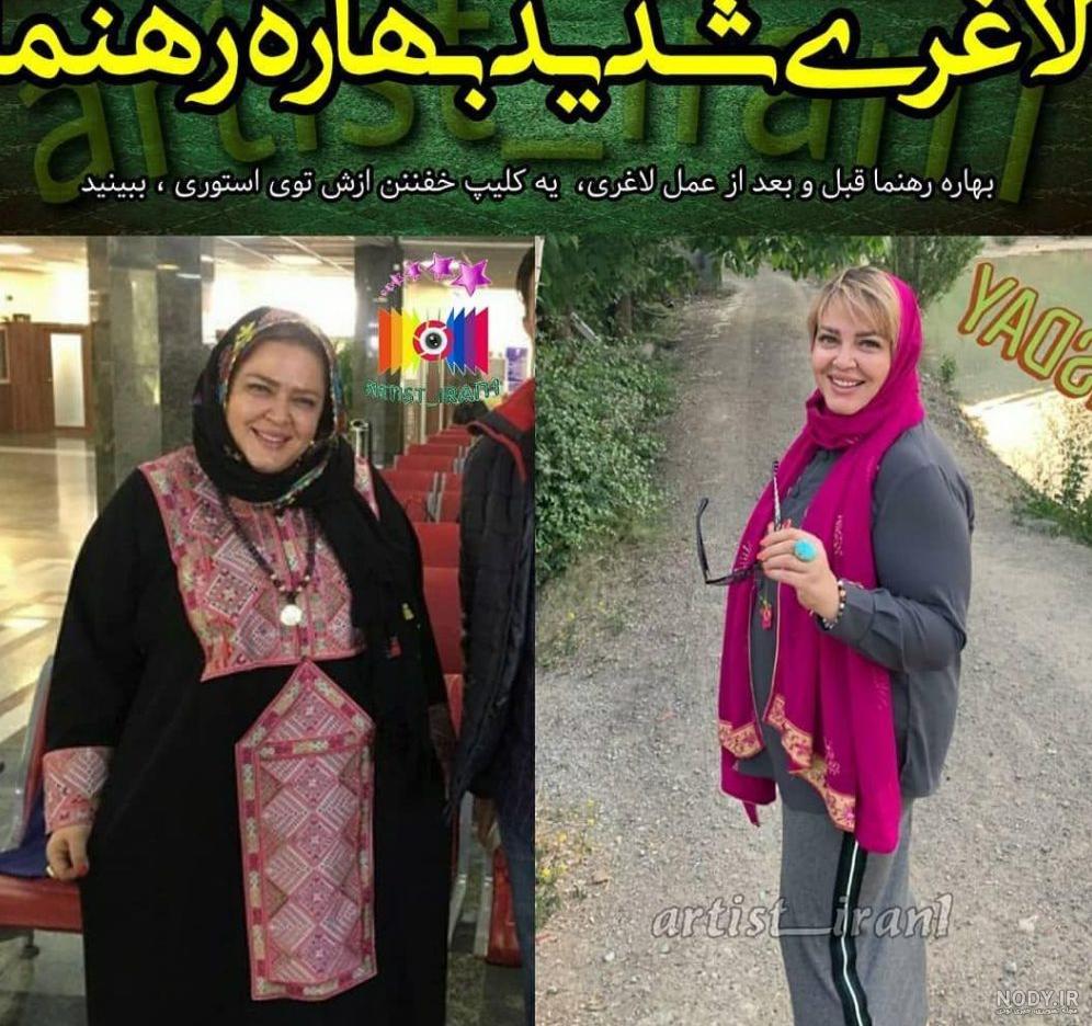 هزینه عمل لاغری بهاره رهنما