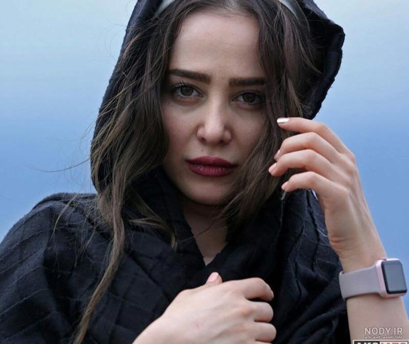 الناز حبیبی قبل از عمل