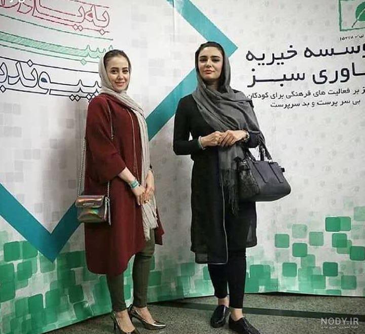 الناز حبیبی قبل از عمل