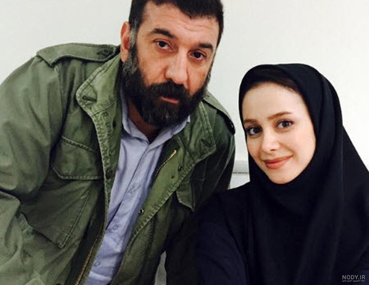 الناز حبیبی قبل از عمل
