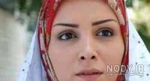 امیرحسین صدهزاری قبل از عمل بینی امیرحسین صدهزاری قبل از عمل بینی