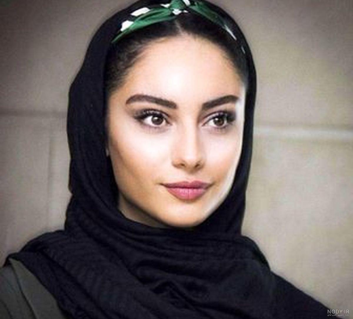 ترلان پروانه قبل عمل چشم