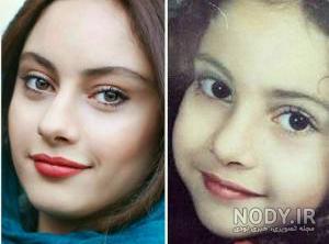 جراحی چشم گربه ای
