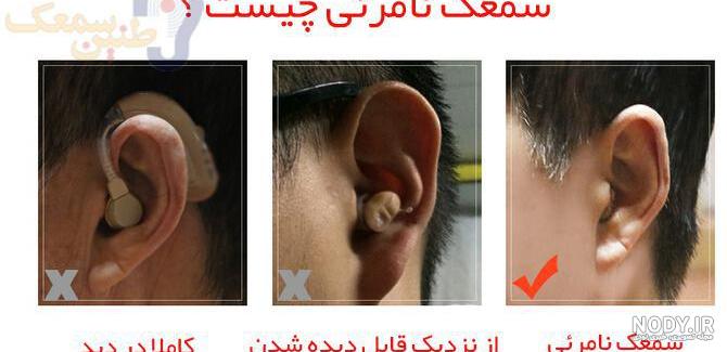 دستگاه کاشت حلزون آمریکایی