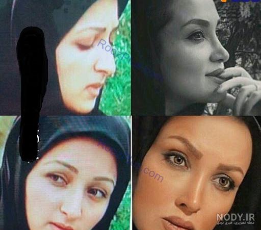 دکتر جراح بینی صبا کمالی دکتر جراح بینی صبا کمالی