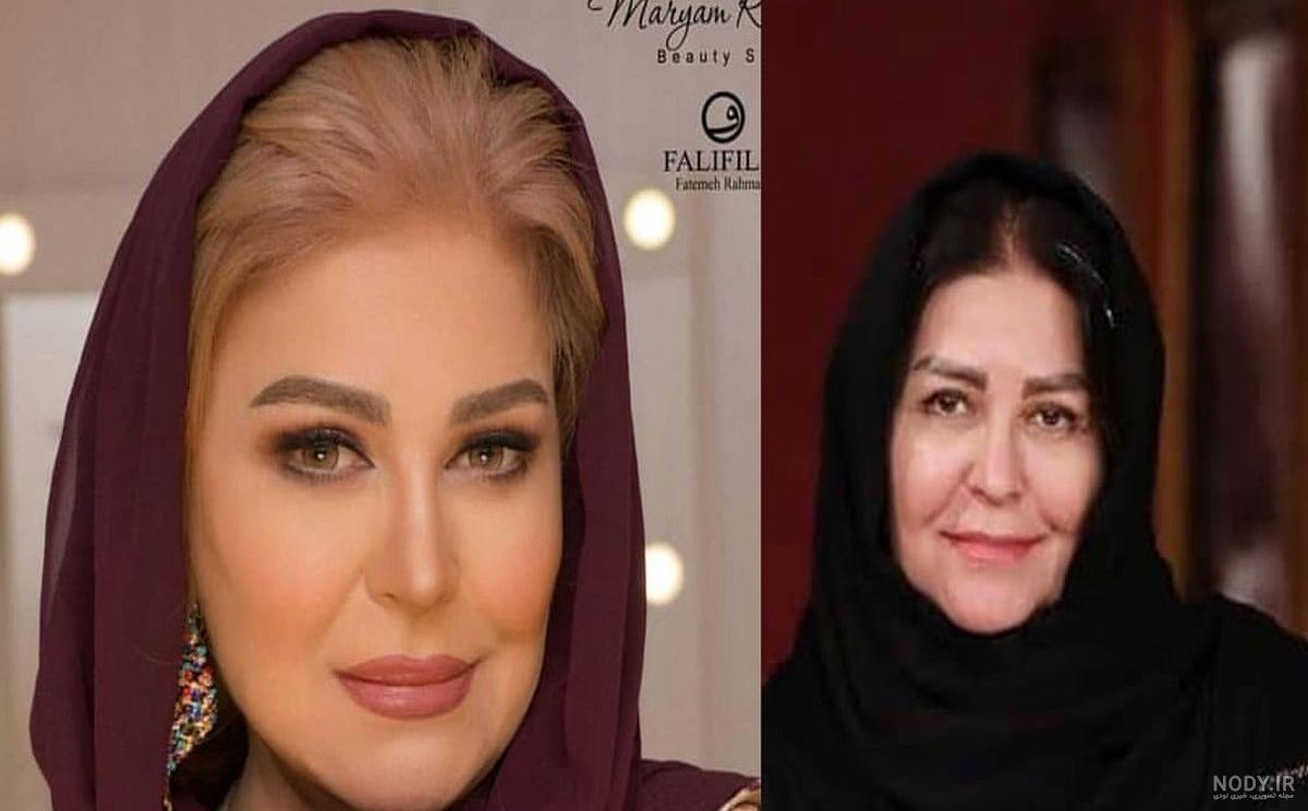شیلا خداداد بعد از عمل فک و صورت شیلا خداداد بعد از عمل فک و صورت