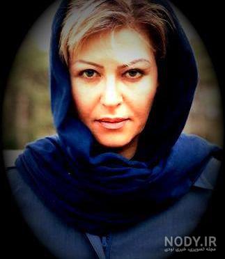 عمل زیبایی مرجانه گلچین عمل زیبایی مرجانه گلچین