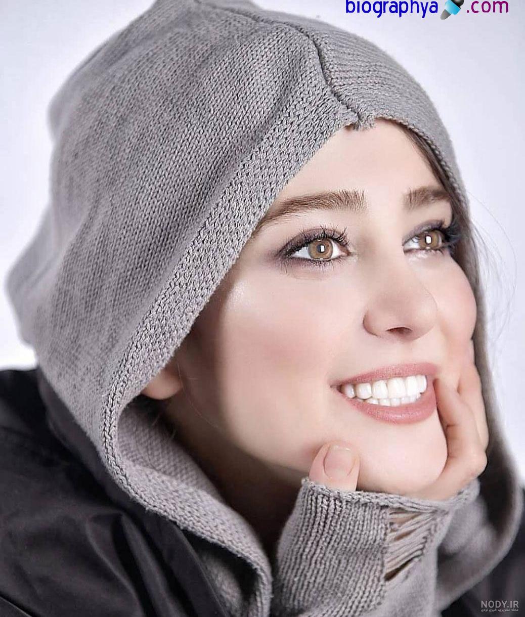 عکس الناز حبیبی قبل از عمل