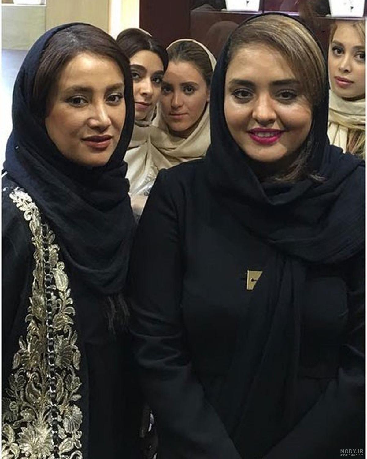 عکس بهاره افشاری قبل از عمل بینی