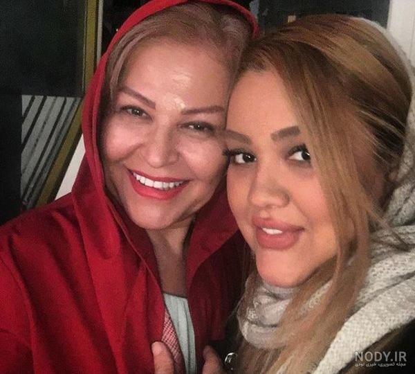 لاله اسکندری قبل از عمل زیبایی لاله اسکندری قبل از عمل زیبایی