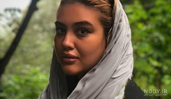 نفیسه روشن بعد از عمل جراحی نفیسه روشن بعد از عمل جراحی