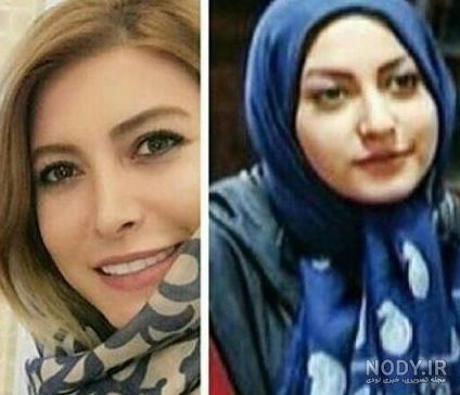 همسر شاهرخ استخری قبل عمل همسر شاهرخ استخری قبل عمل