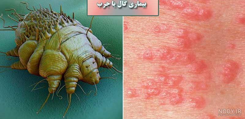 ویروس گالری عکس ویروس گالری عکس