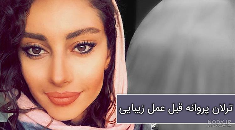 چشم ترلان پروانه نی نی سایت