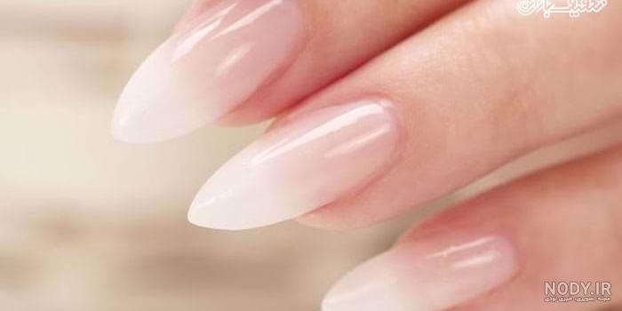 کاشت بیبی بومر چیست