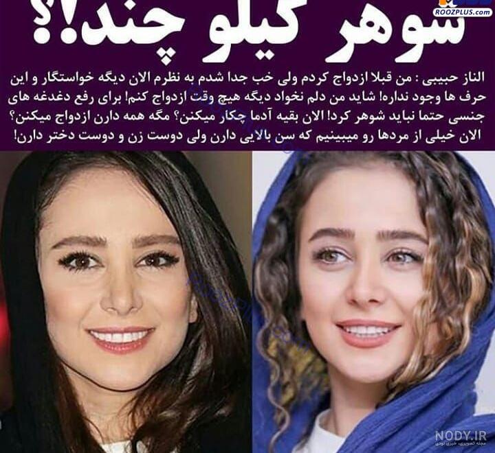 الناز حبیبی قبل از عمل الناز حبیبی قبل از عمل