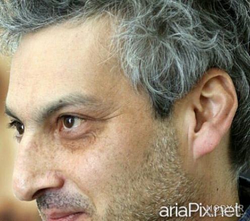 بیماری ارژنگ امیرفضلی