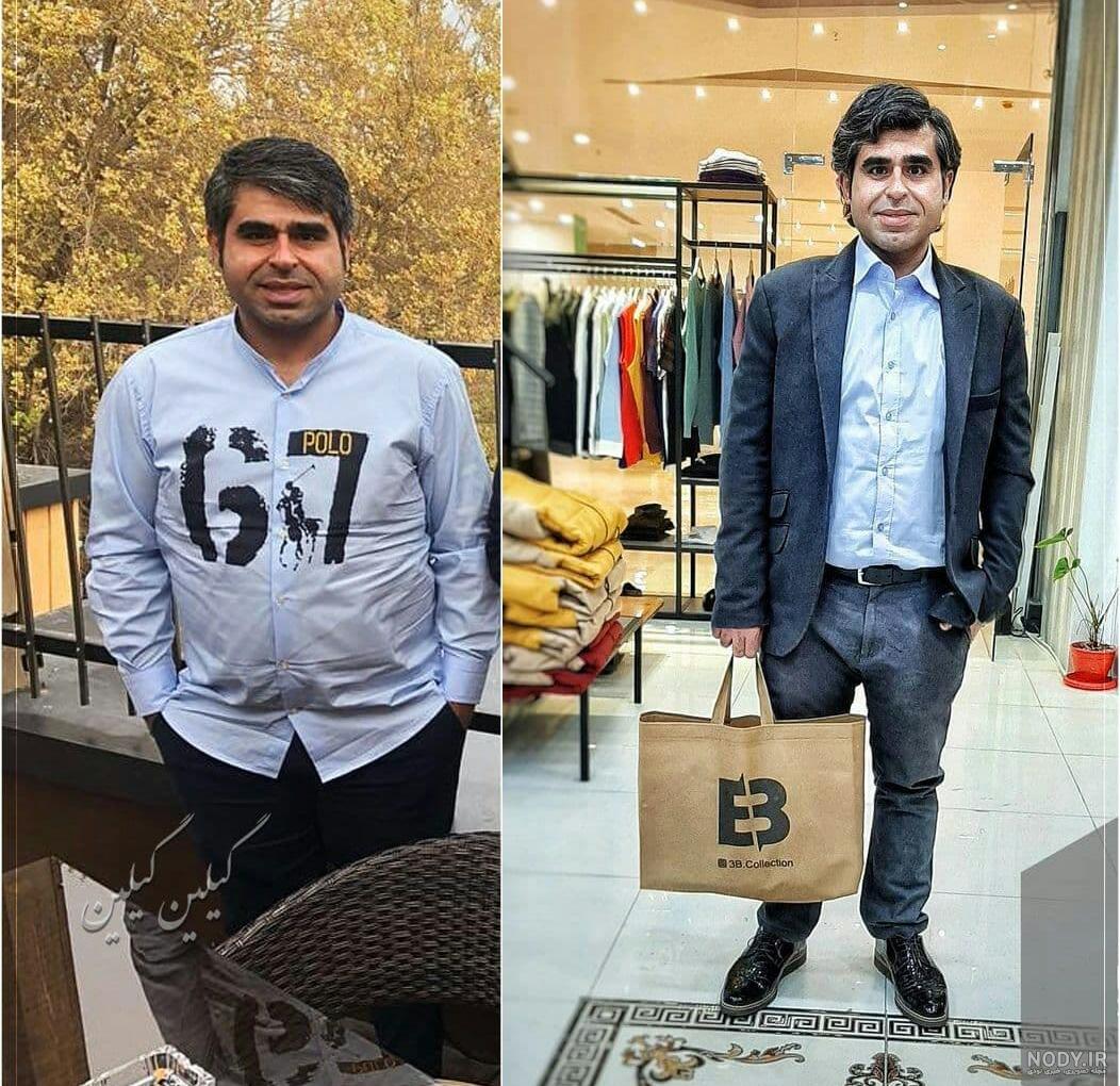 بیماری امیر نوری بیماری امیر نوری