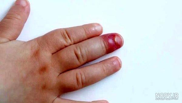 ترفند ناخن آپارات ترفند ناخن آپارات