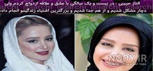 تصاویر الناز حبیبی قبل از عمل بینی