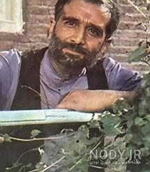 سرطان دست دنیا فنی زاده