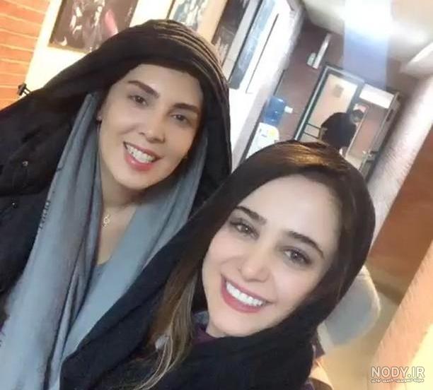 عکس الناز حبیبی قبل از عمل