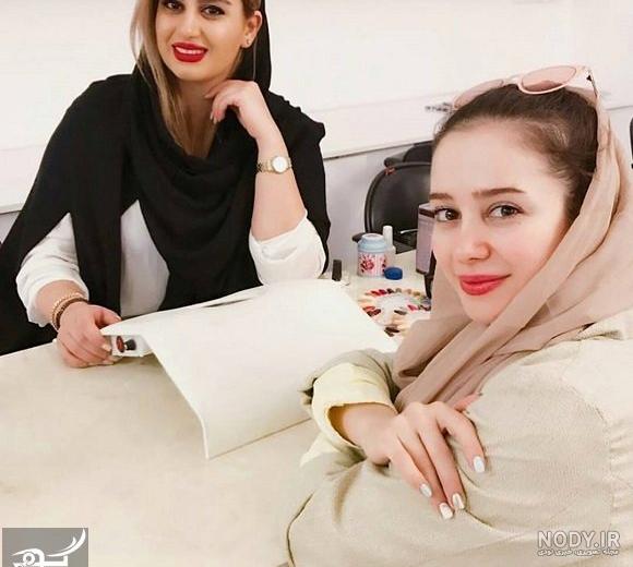 عکس الناز حبیبی قبل از عمل