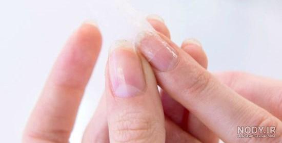 عکس ناخن شکسته دست عکس ناخن شکسته دست
