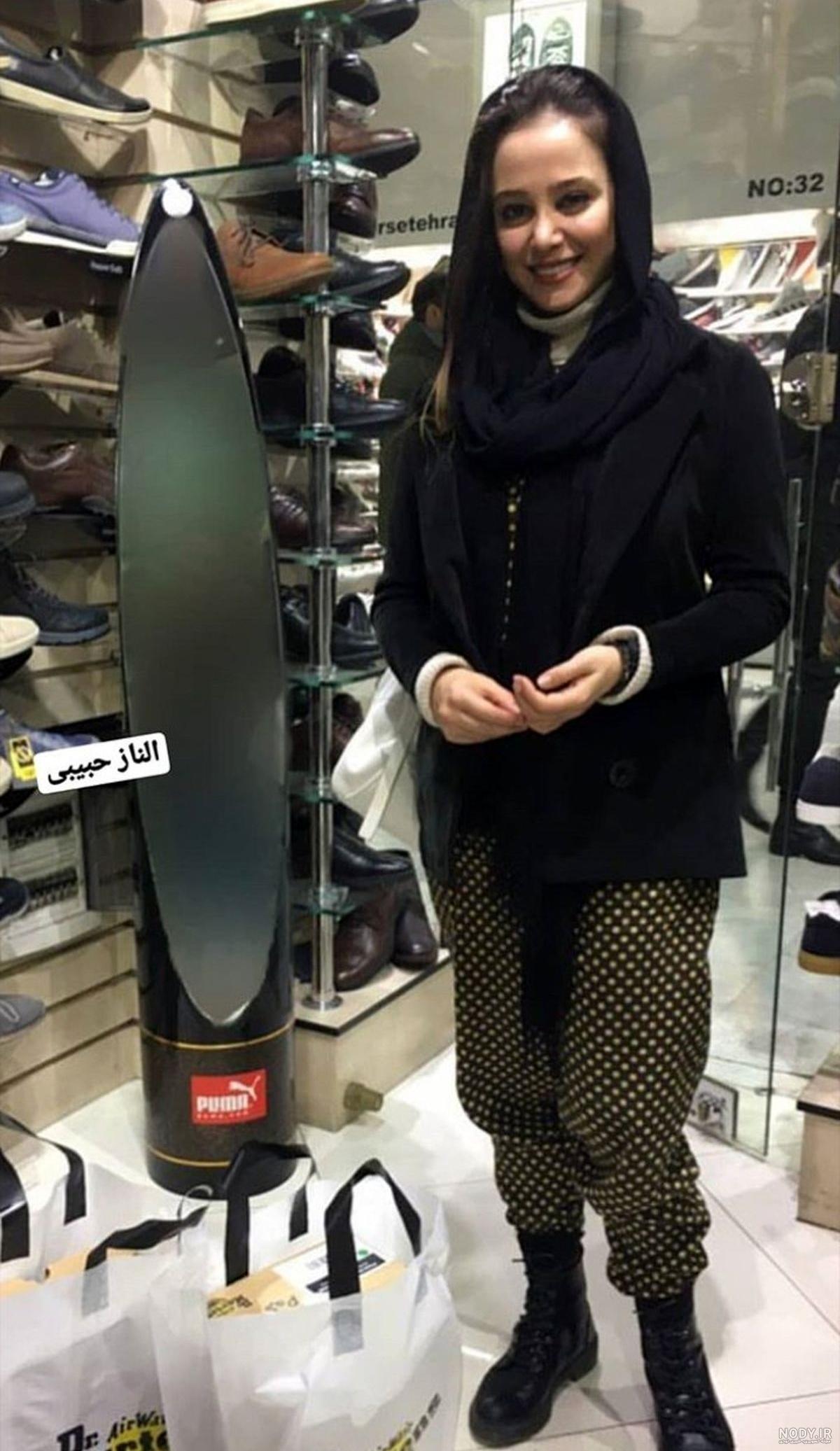 الناز حبیبی قبل از عمل بینی