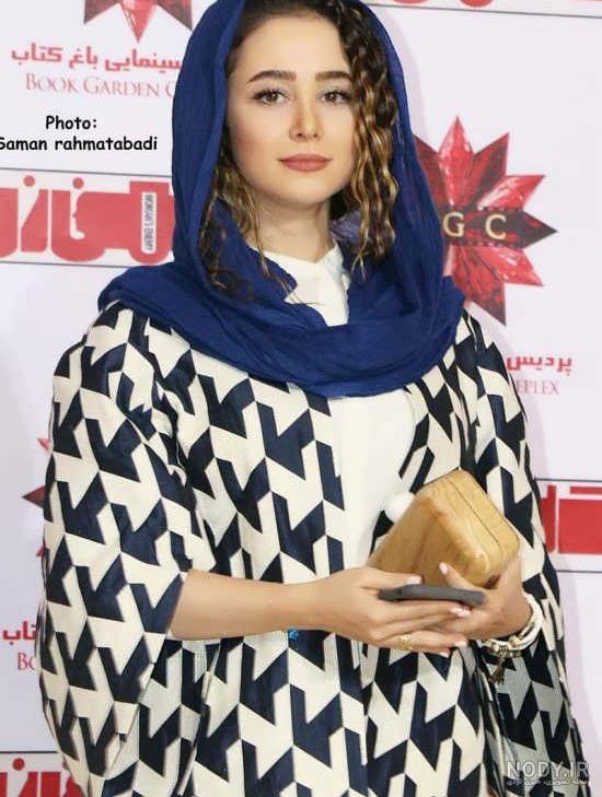 الناز حبیبی قبل از عمل بینی