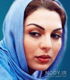 الیزابت امینی قبل از عمل الیزابت امینی قبل از عمل