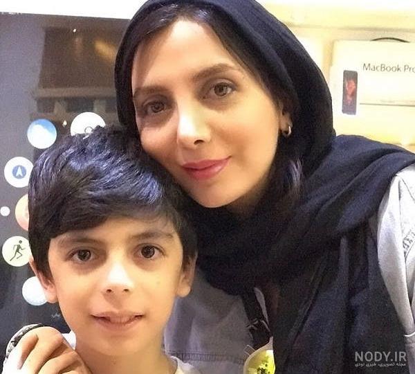 رویا میرعلمی قبل از عمل زیبایی رویا میرعلمی قبل از عمل زیبایی