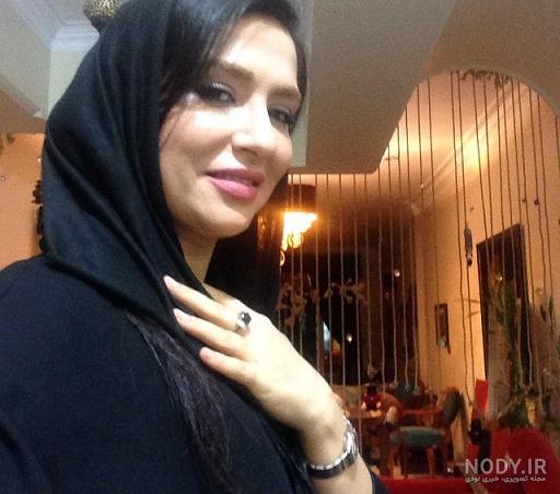 ساغر عزیزی در پیشونی سفید