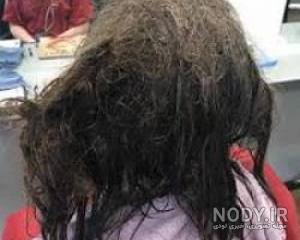 علت شپش سر در بزرگسالان علت شپش سر در بزرگسالان