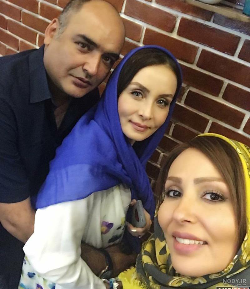 عکس بازیگران ترکیه قبل و بعد از عمل زیبایی