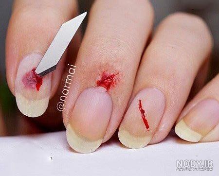 عکس کاشت ناخن ترسناک