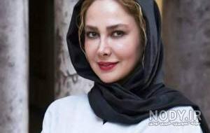آنا نعمتی قبل عمل آنا نعمتی قبل عمل
