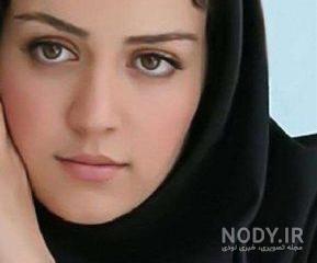 افسانه پاکرو قبل و بعد عمل بینی افسانه پاکرو قبل و بعد عمل بینی