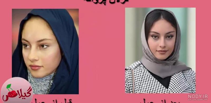 برادر ترلان پروانه
