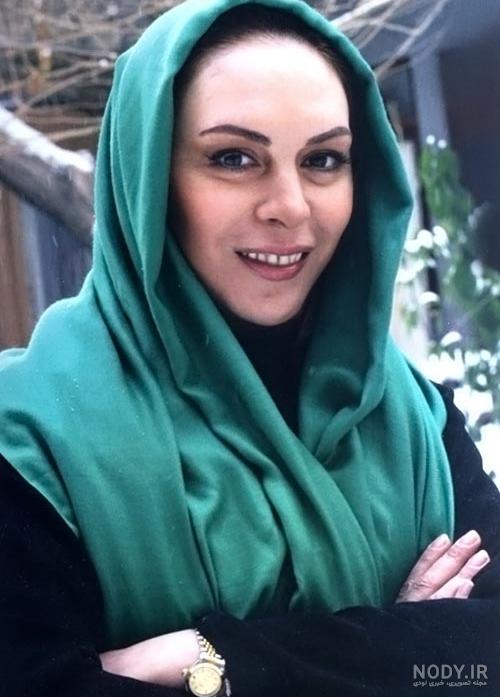 بیماری افسانه بایگان