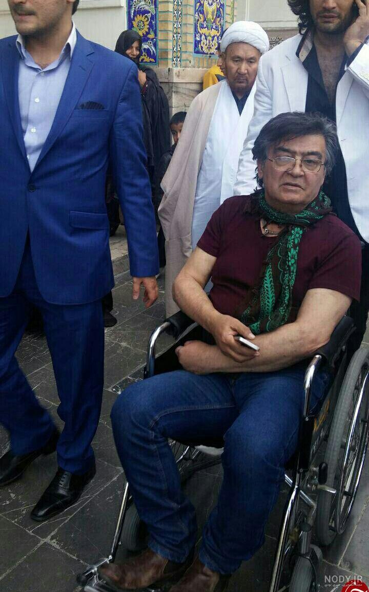 بیماری رضا رویگری بیماری رضا رویگری