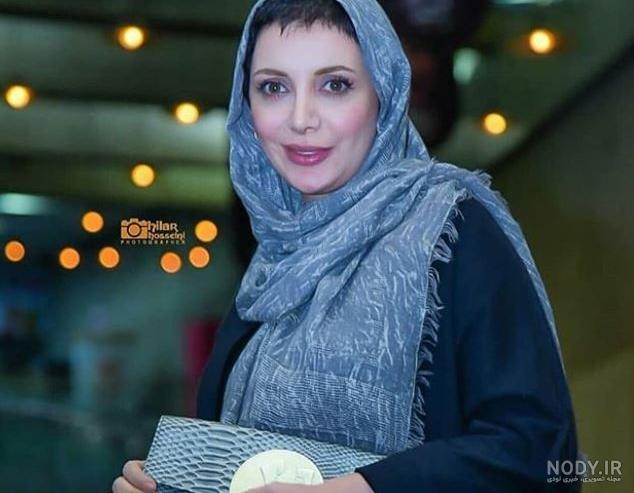 رویا میرعلمی قبل از عمل زیبایی رویا میرعلمی قبل از عمل زیبایی