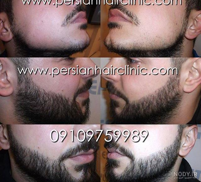 ریش و سبیل آنلاین ریش و سبیل آنلاین